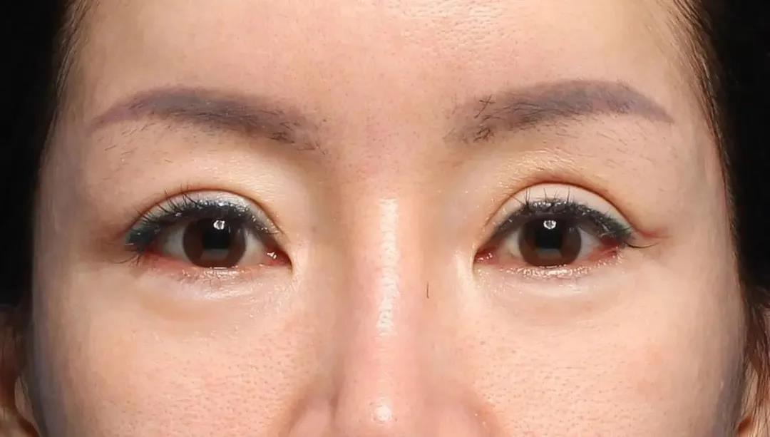 观眼识人术，通过眼睛看性格与运势，准得你不得不信！