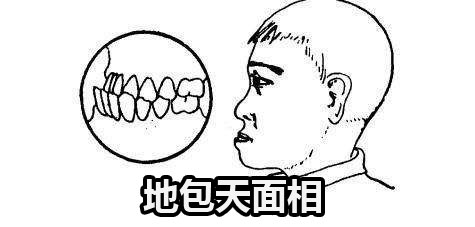 地包天面相的男人真的是穷人吗