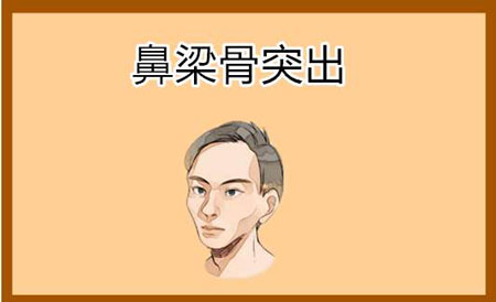 鼻骨突出面相的人生活会怎么样