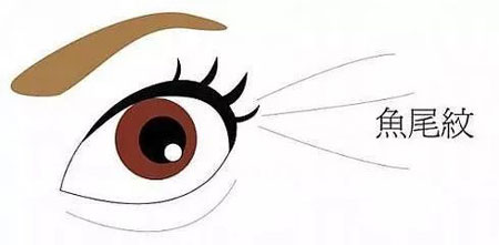 鱼尾纹上翘的女人性格会怎么样