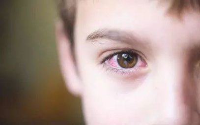 霉运当头做生意血本无归的人面相特征