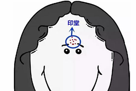 印堂上长痘代表着什么呢