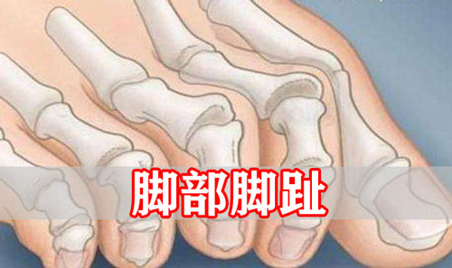 脚部脚趾的体相算命解析