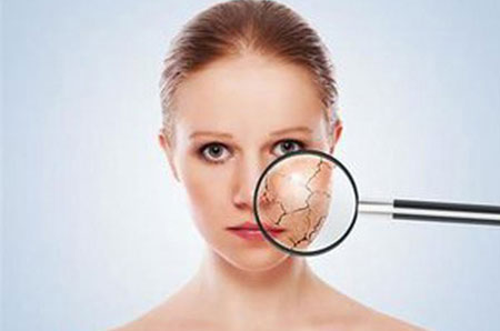 女人皮肤粗糙对运势的影响