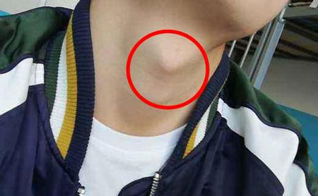 男人喉结大的体相通常代表什么