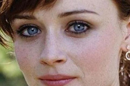 眼球能反映出身体健康的问题吗