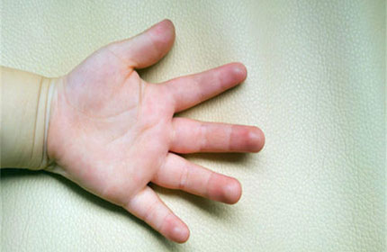 从儿童的手纹能看出什么呢