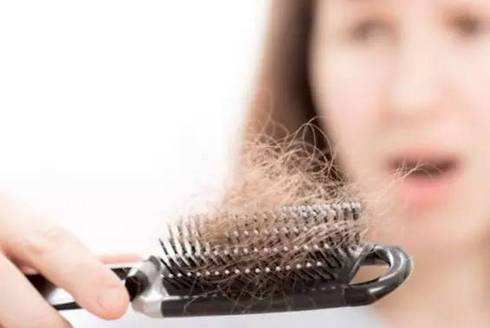 掉发严重怎么半？这里教你如何日常养护