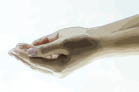 手相解读你的健康运是怎么样